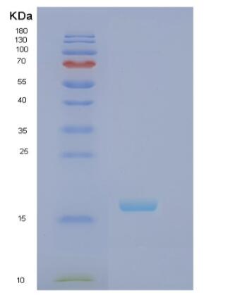 Recombinant Human RBP7 Protein