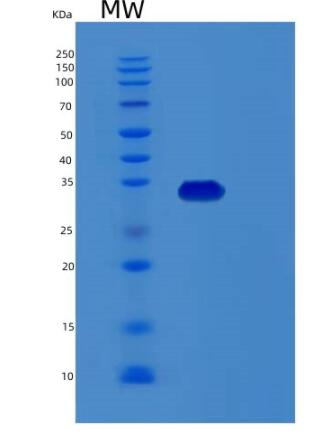 Recombinant Human RDH12 Protein