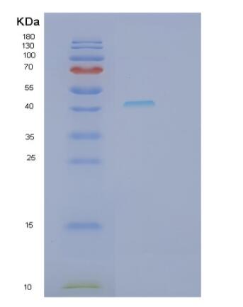 Recombinant Human REN Protein