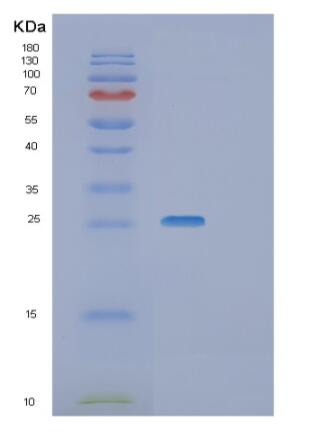 Recombinant Human RGS4 Protein