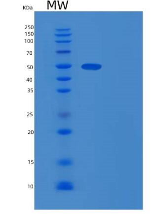 Recombinant Human RNMTL1 Protein