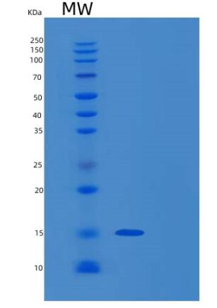 Recombinant Human ROBLD3 Protein