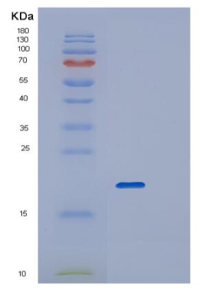 Recombinant Human RPL26L1 Protein