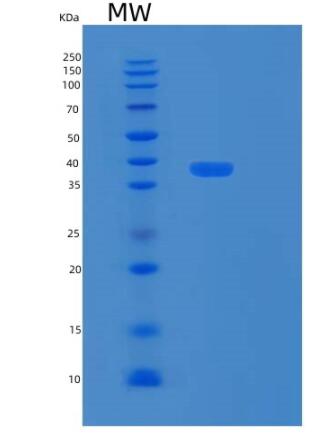 Recombinant Human RPRD1B Protein