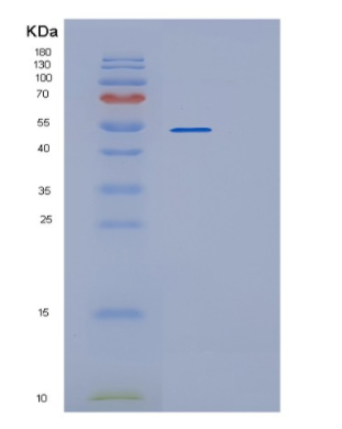 Recombinant Human RUVBL1 Protein