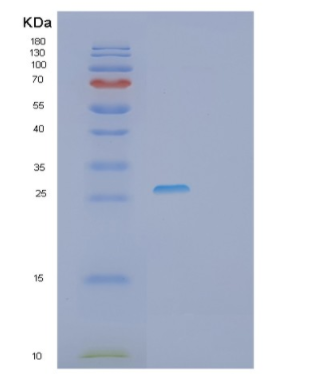 Recombinant Human RYBP Protein