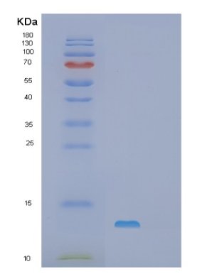 Recombinant Mouse S100A1 Protein