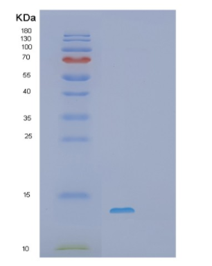 Recombinant Human S100A10 Protein