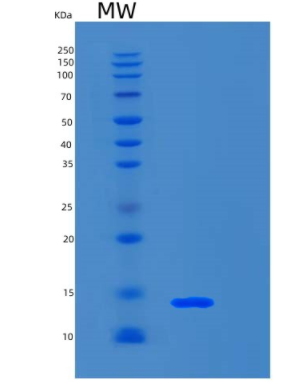 Recombinant Human S100A4 Protein