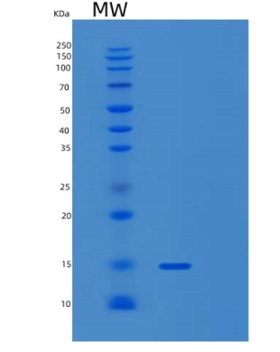 Recombinant Human SAA4 Protein