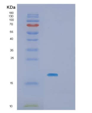 Recombinant Human SBDS Protein