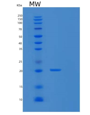 Recombinant Human SCAND1 Protein