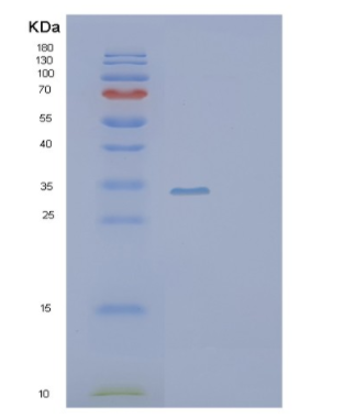 Recombinant Human SCGN Protein