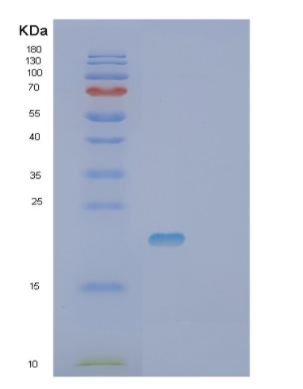 Recombinant Human SCN3B Protein