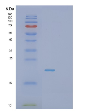 Recombinant Human SCO1 Protein