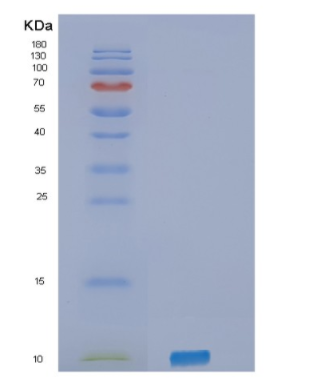 Recombinant Human SELPLG Protein