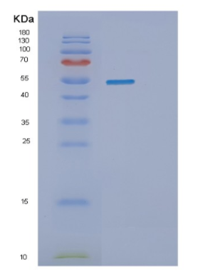 Recombinant Human SEMG1 Protein