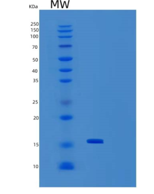 Recombinant Human SEP15 (SC96C) Protein