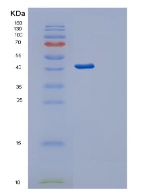 Recombinant Human Serpin A5 Protein