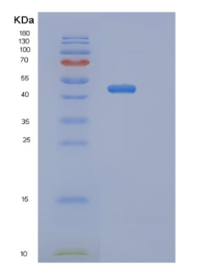 Recombinant Mouse Serpina9 Protein