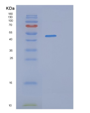 Recombinant Human SERPINB2 Protein