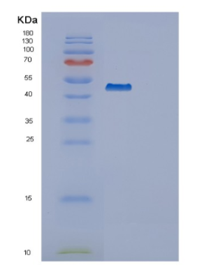 Recombinant Human SERPINB3 Protein