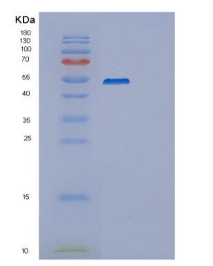 Recombinant Human SERPINB4 Protein