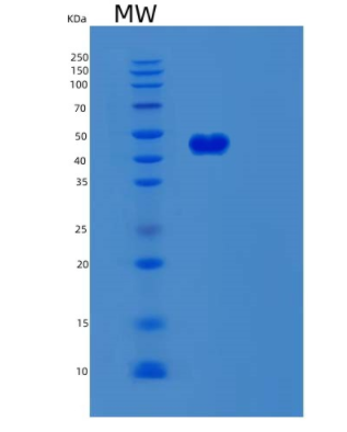 Recombinant Human SERPINB8 Protein