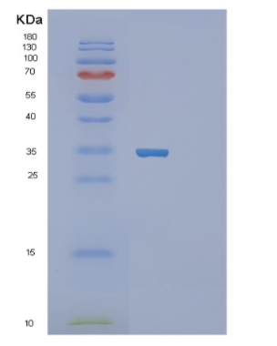 Recombinant Human SFRP2 Protein