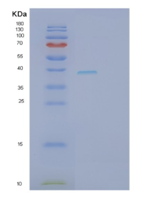 Recombinant Human SFRP4 Protein