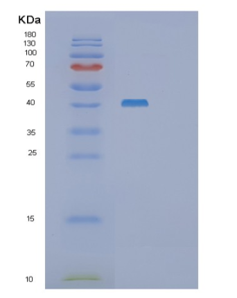 Recombinant Human SET7/9 Histone methyltransferase Protein