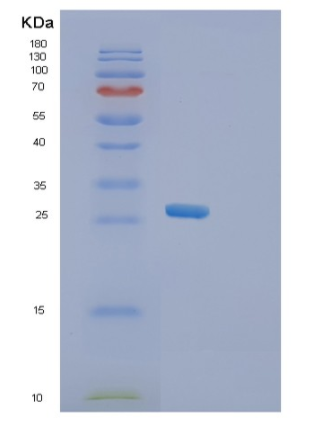 Recombinant Human SGCD Protein