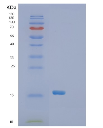 Recombinant Human SH2D1A Protein