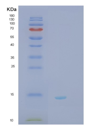 Recombinant Human SH3BGRL2 Protein