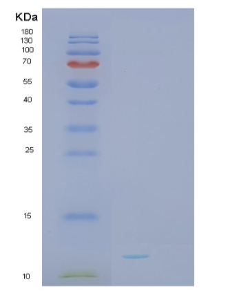 Recombinant Human SH3BGRL3 Protein