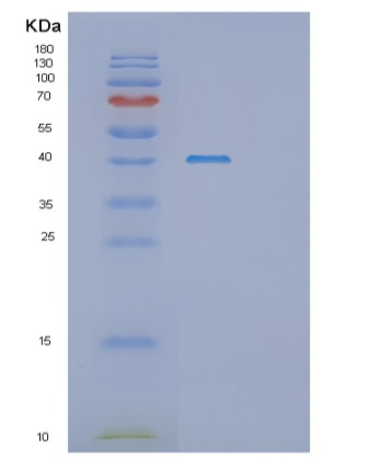 Recombinant Human SH3GL2 Protein