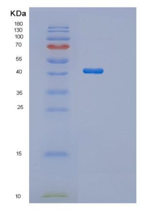Recombinant Human SH3GL3 Protein