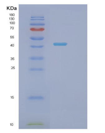 Recombinant Human SH3GLB2 Protein