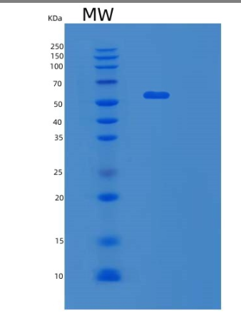Recombinant Human SHMT1 Protein