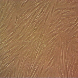 NCTC 2472小鼠纤维肉瘤细胞