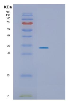 Recombinant Human SLA2 Protein