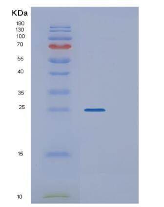 Recombinant Human SLAMF1 Protein