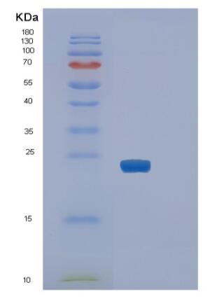 Recombinant Human SLAM family member 7 Protein