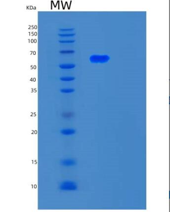 Recombinant Human SMAD4 Protein