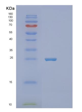 Recombinant Human SLAMF6 Protein