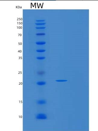 Recombinant Human SMAC/Diablo Protein