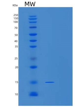 Recombinant Human SNRPD2 Protein