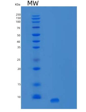 Recombinant Human SPINK1 Protein