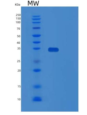 Recombinant Human SPRY4 Protein