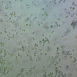 H1975/LUC人非小细胞肺腺癌细胞